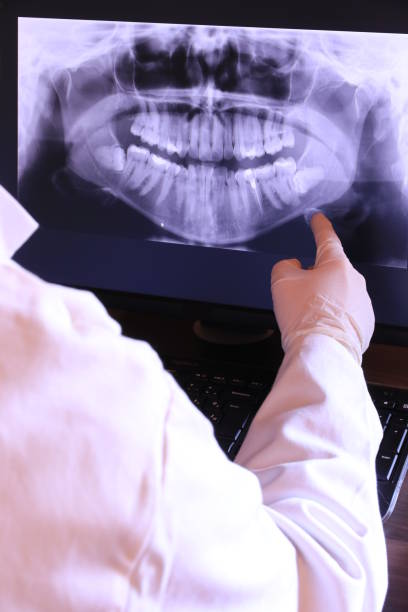 Best Emergency Dental Surgery in East Griffin, GA