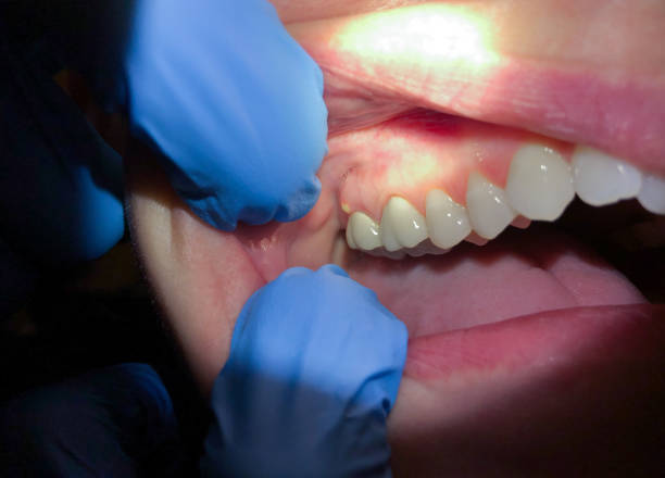 Best Emergency Dental Care for Trauma or Injury in East Griffin, GA