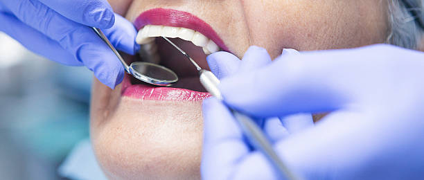 Best Emergency Broken Tooth Repair in East Griffin, GA